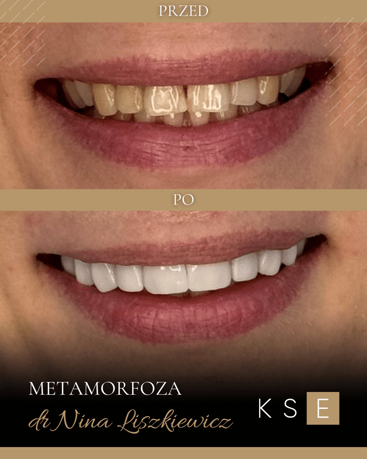dr-nina-liszkiewicz-kse-wloclawek-metamorfoza-przed-po